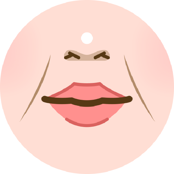 老化型法令紋：膠原蛋白、彈力蛋白流失與韌帶鬆弛，臉部支撐力下降，紋路向下延伸到嘴角且常常伴隨木偶紋