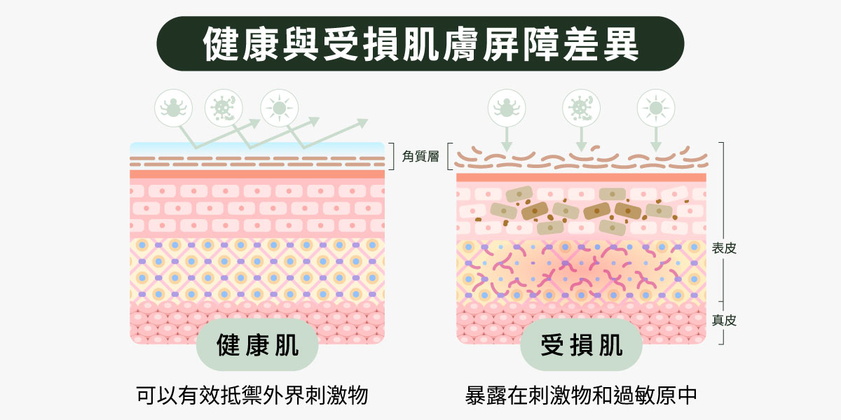 健康與受損肌膚屏障差異