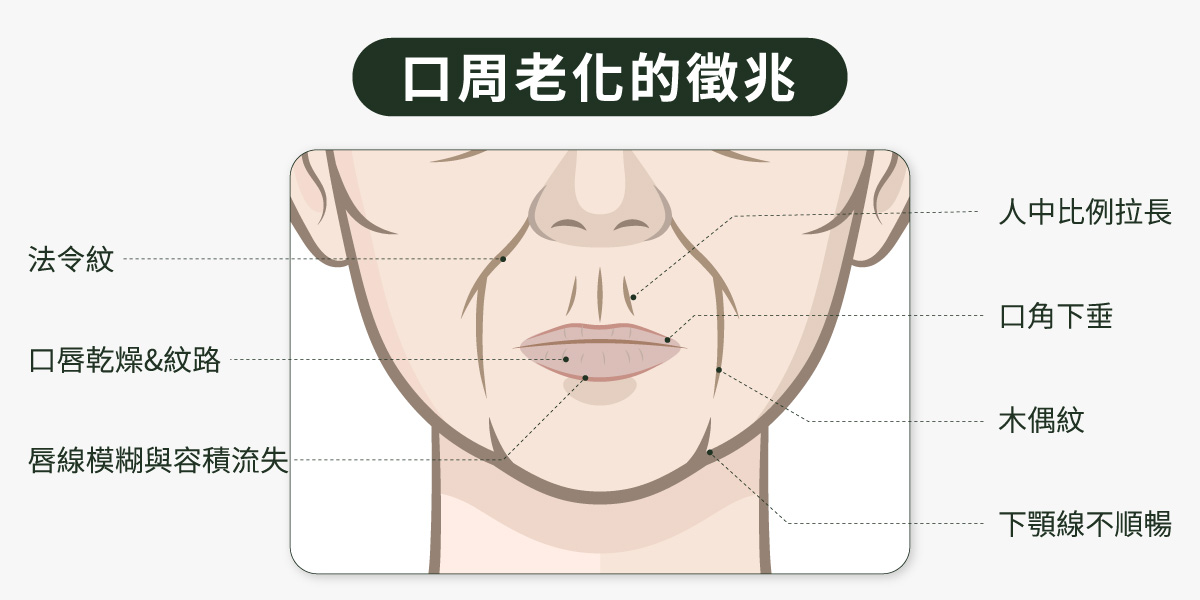 口周老化的徵兆