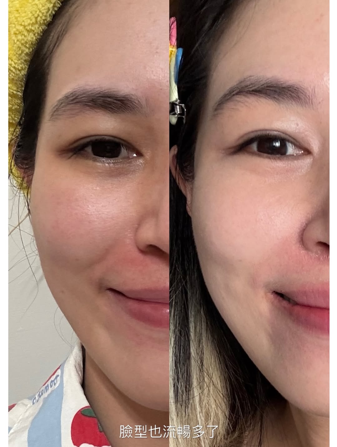 媚必提-AKA-下顎線BA02