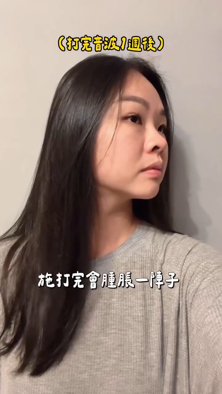 海芙音波-伊娃Eva-1週後