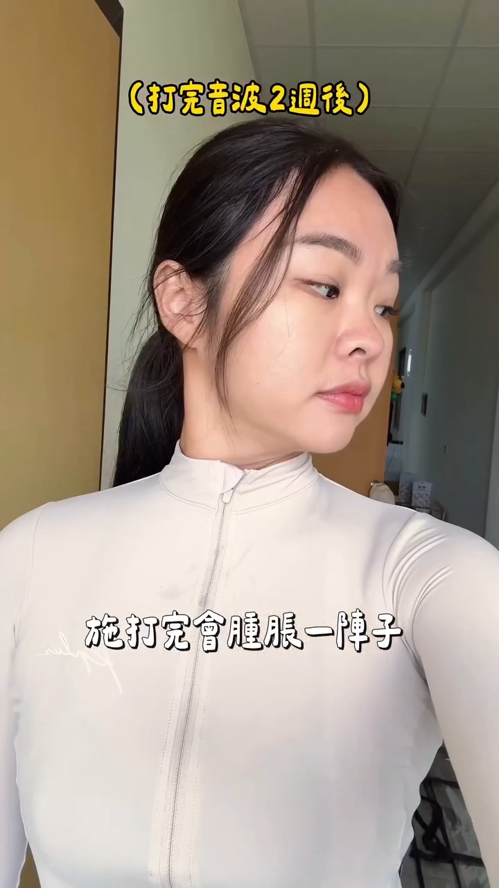 海芙音波-伊娃Eva-2週後