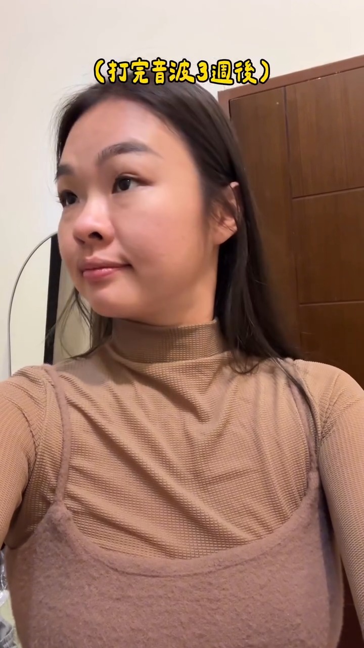 海芙音波-伊娃Eva-3週後