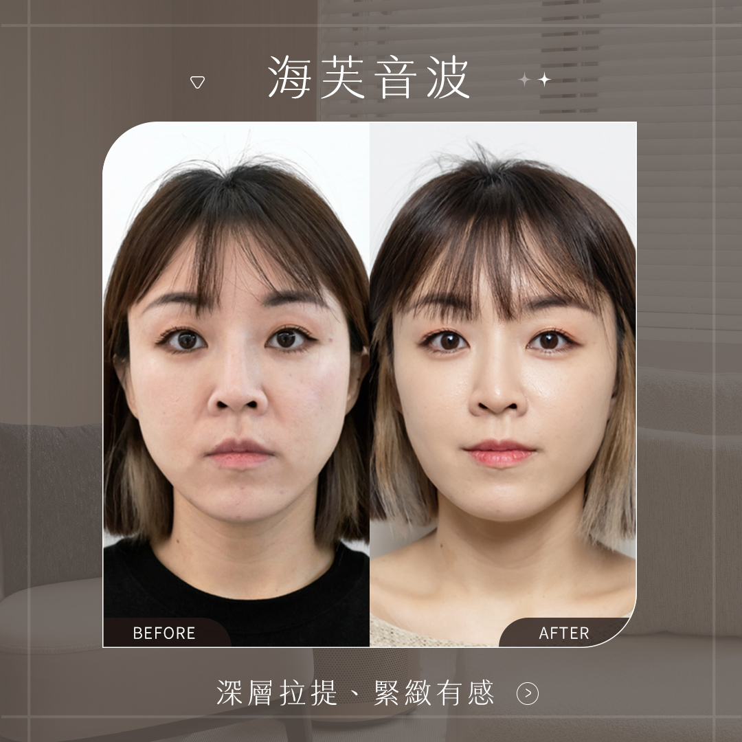 海芙音波_深層拉提、緊緻有感