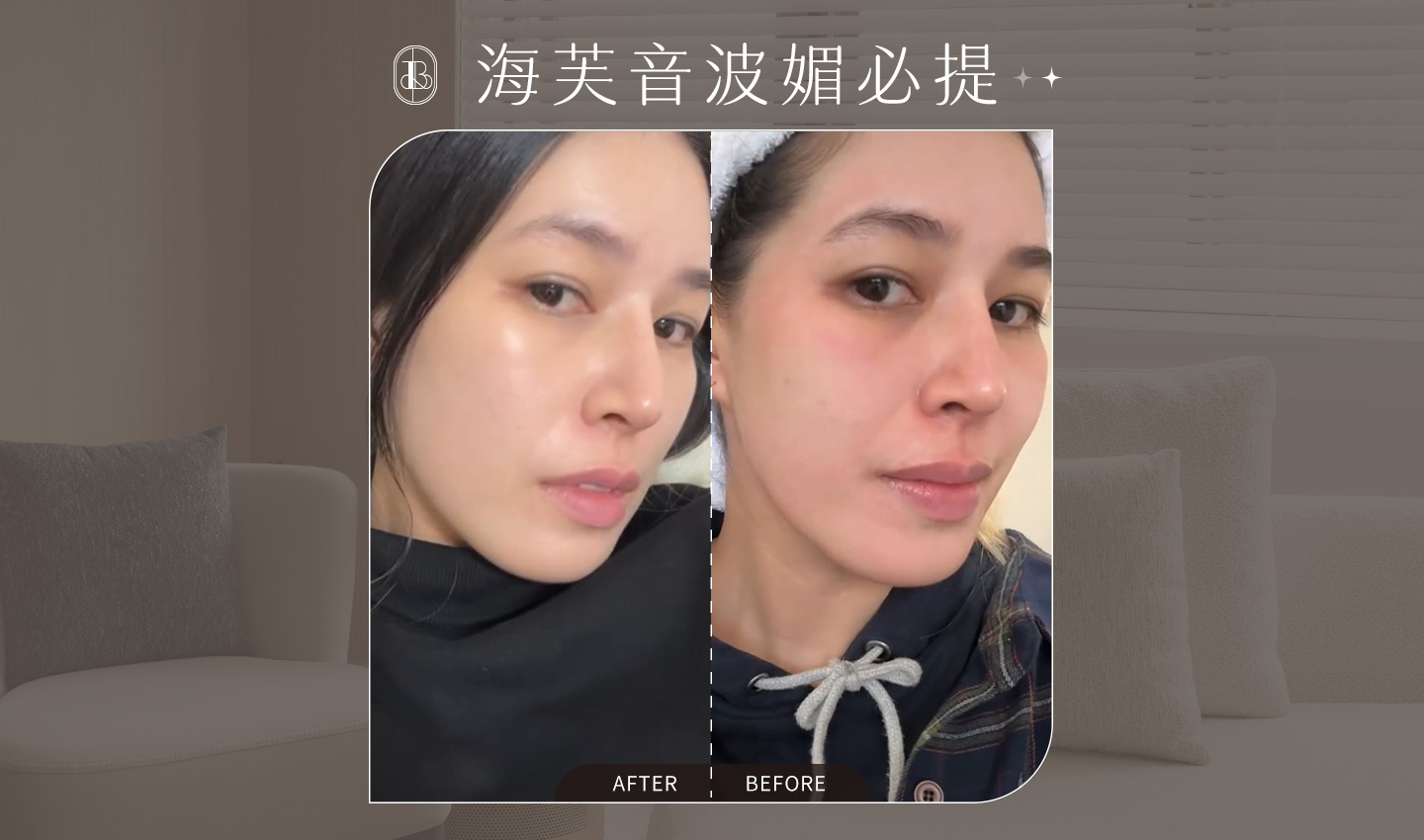 海芙音波媚必提-KOL-AKA-BA