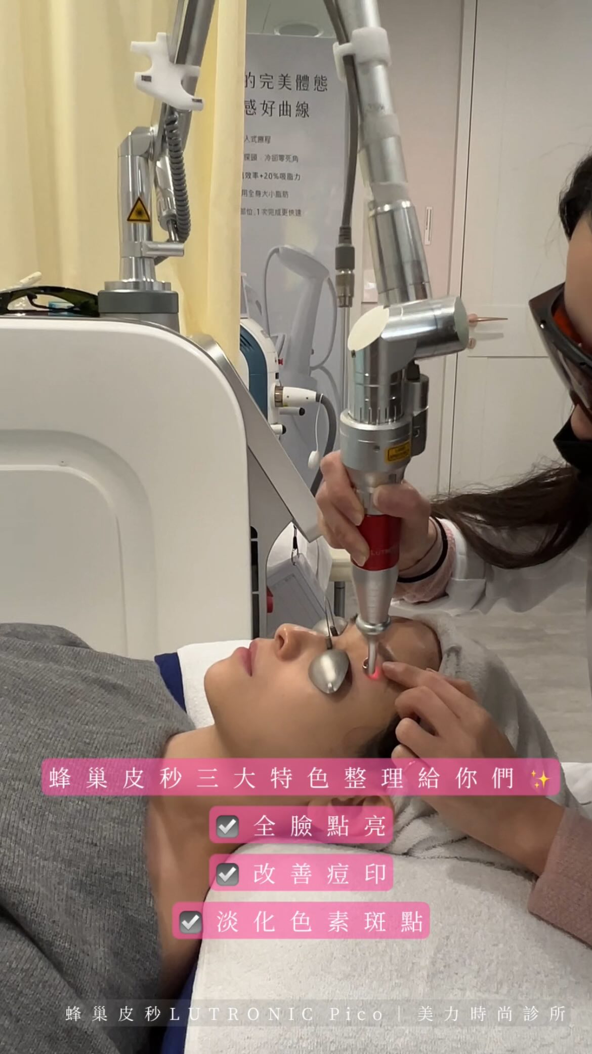 蜂巢皮秒特色 全臉提亮、改善痘印、淡化色素斑點