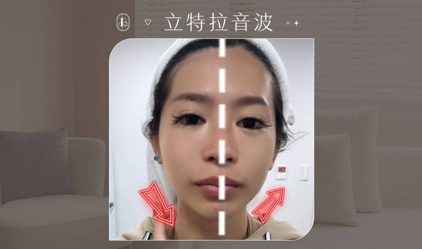 立特拉音波-柔E老師BA