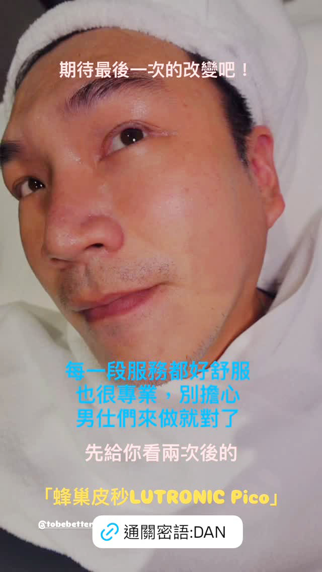 KOL阿丹-第三次施作