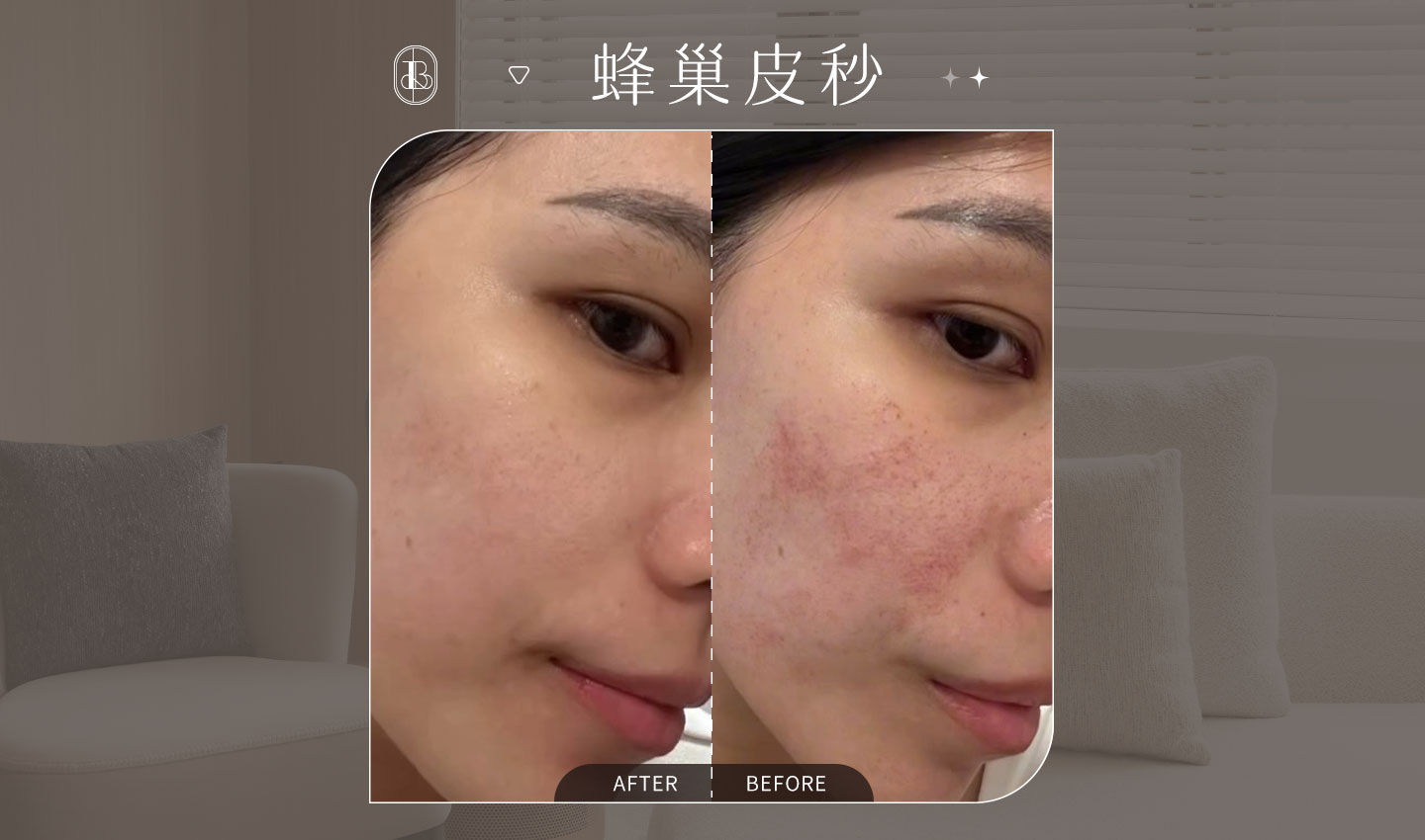 蜂巢皮秒-琳恩-Lynn-BA