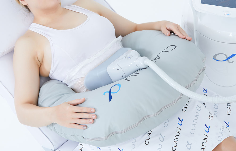 阿爾發 冷凍減脂 治療肚子照片