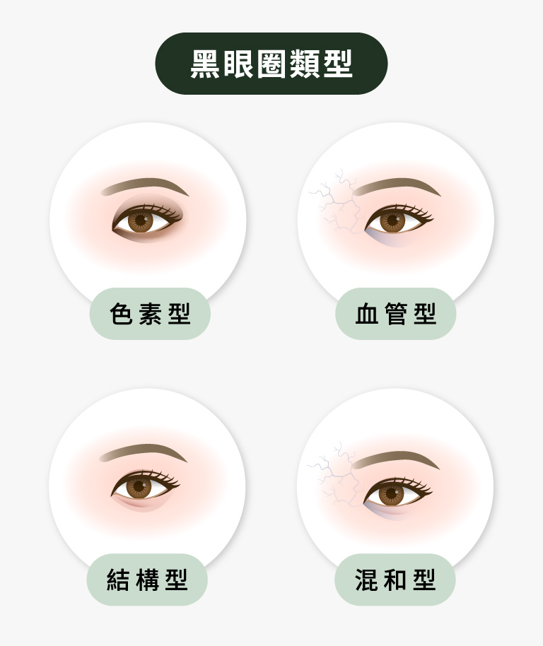 黑眼圈類型