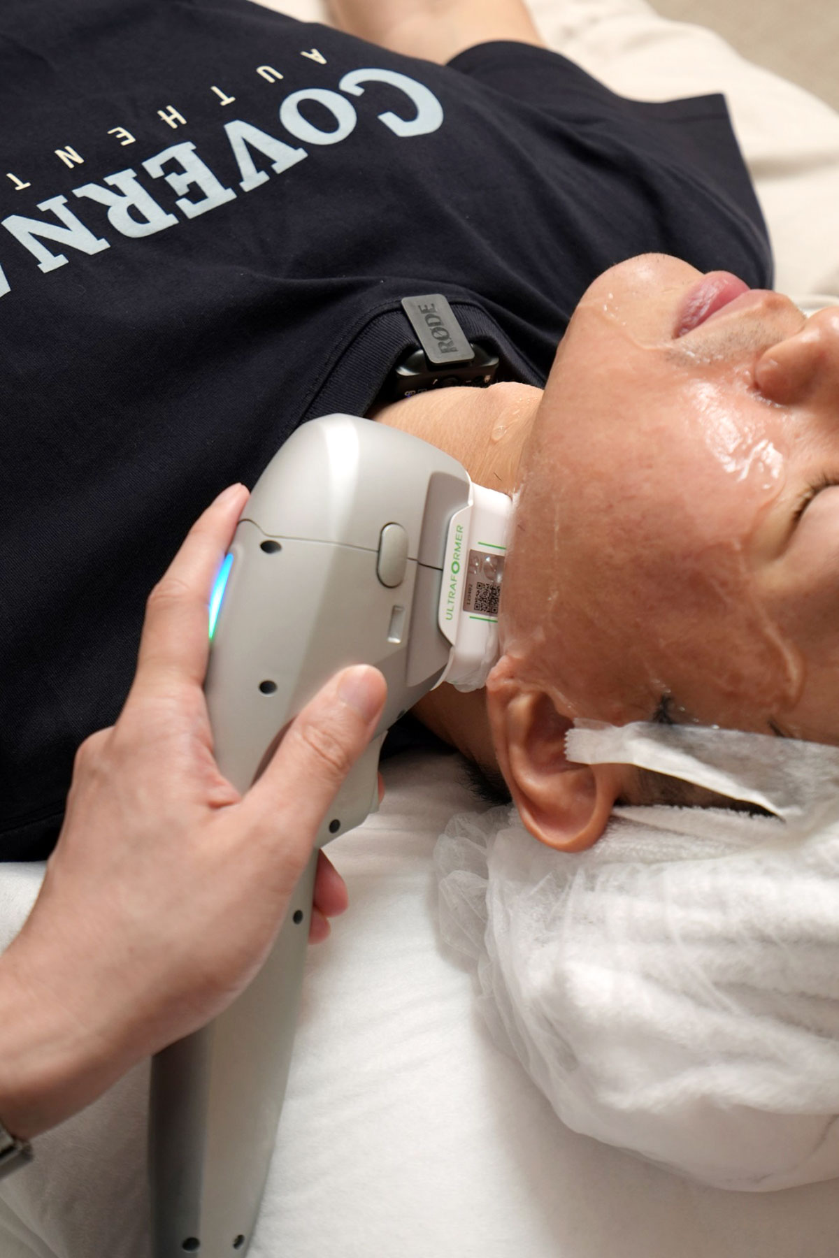 醫師施打海芙音波下顎線部位