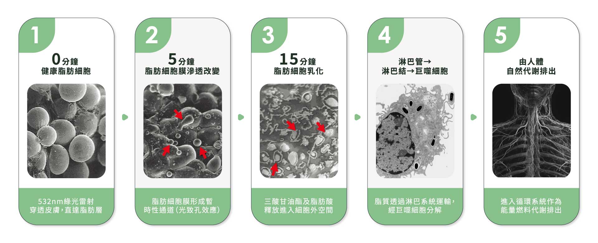 綠寶石減脂雷射-脂肪代謝5步驟