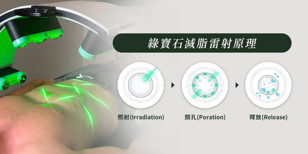 綠寶石減脂雷射原理