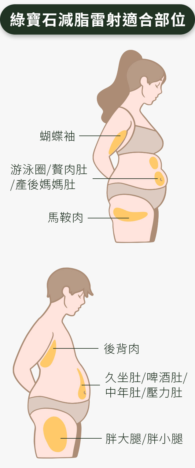 綠寶石減脂雷射適合部位