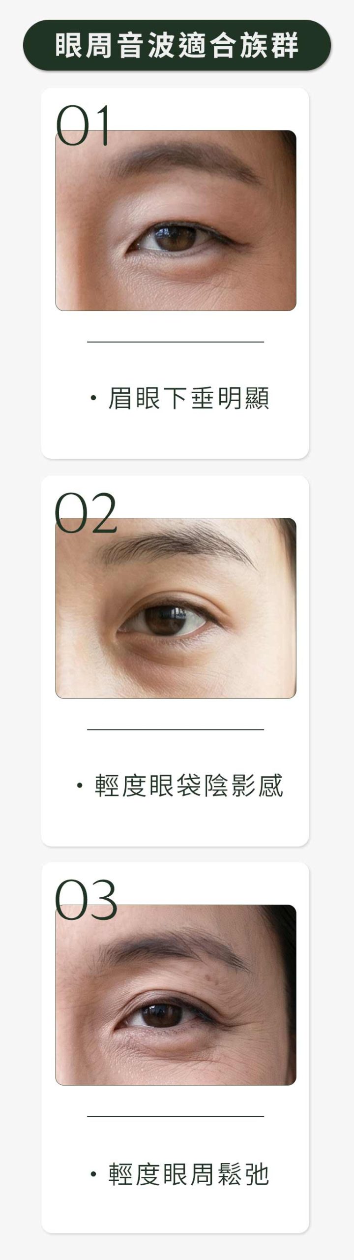 眼周音波適合族群
