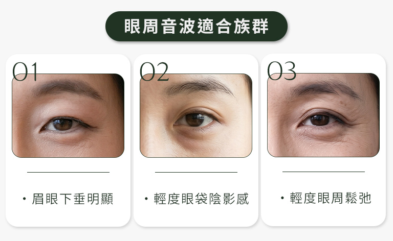 眼周音波適合族群