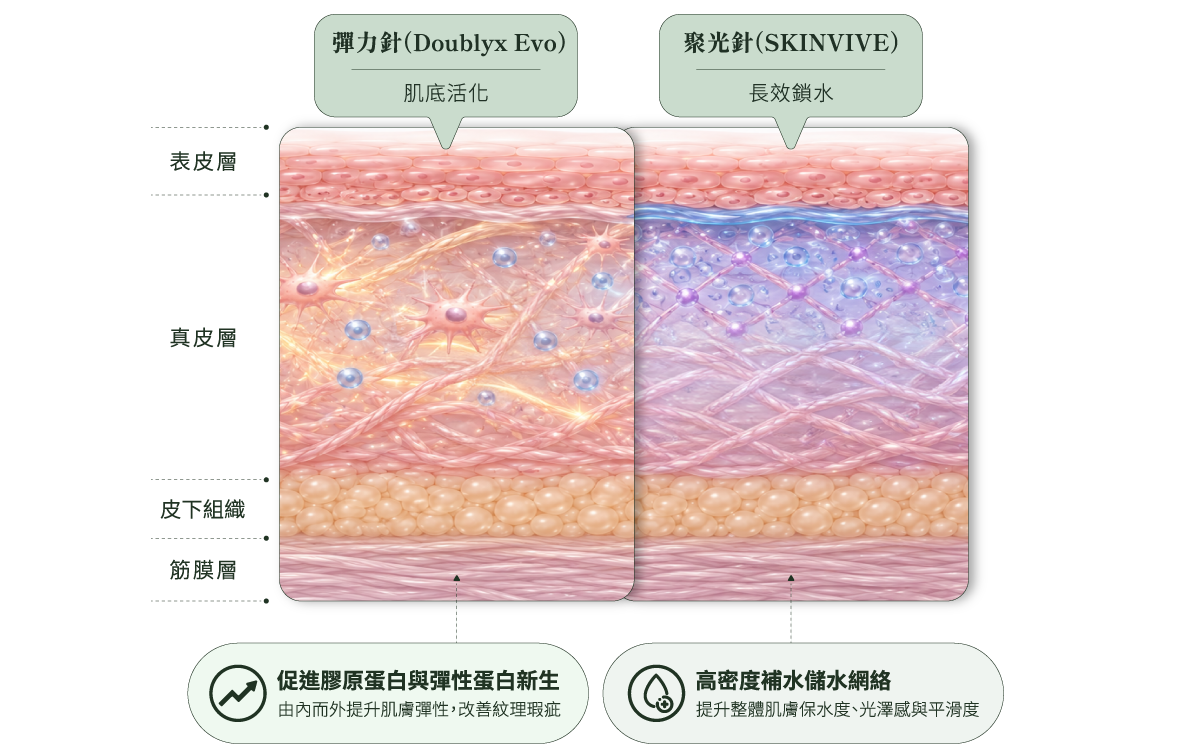彈力針與聚光針施作層次比較
