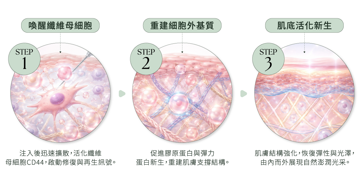 彈力針三步驟作用機制