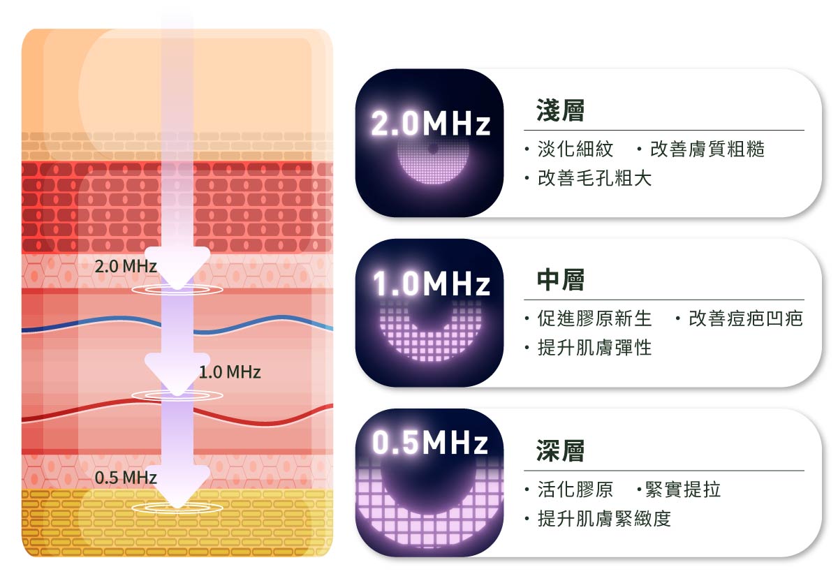 神比三頻微針電波_三種頻率x肌膚層次