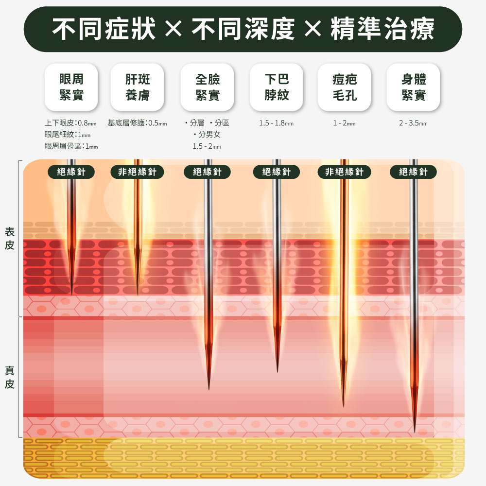 神比三頻微針電波_59 階微針深度調控_不同症狀×不同深度×精準治療
