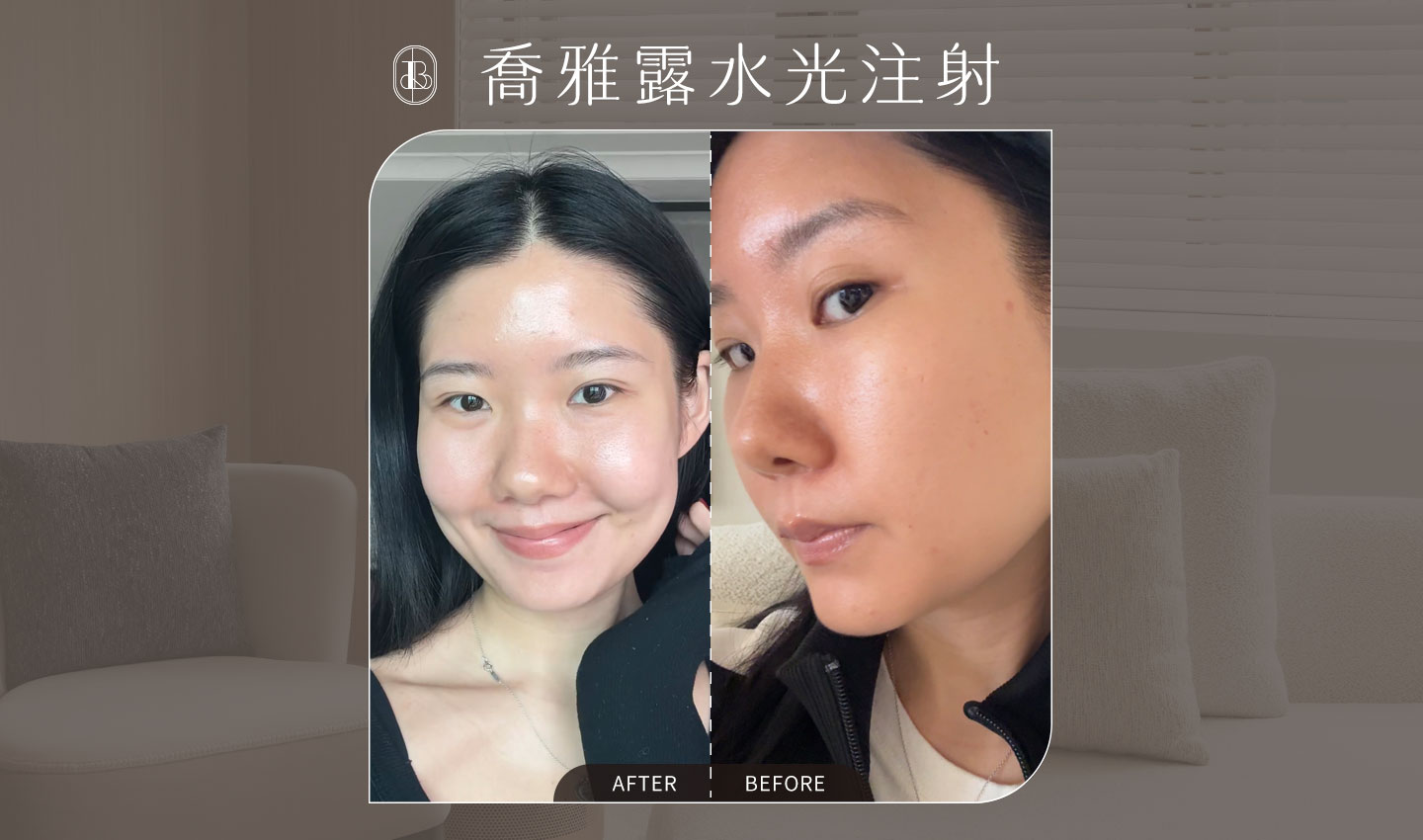 喬雅露水光針-Angela-cover