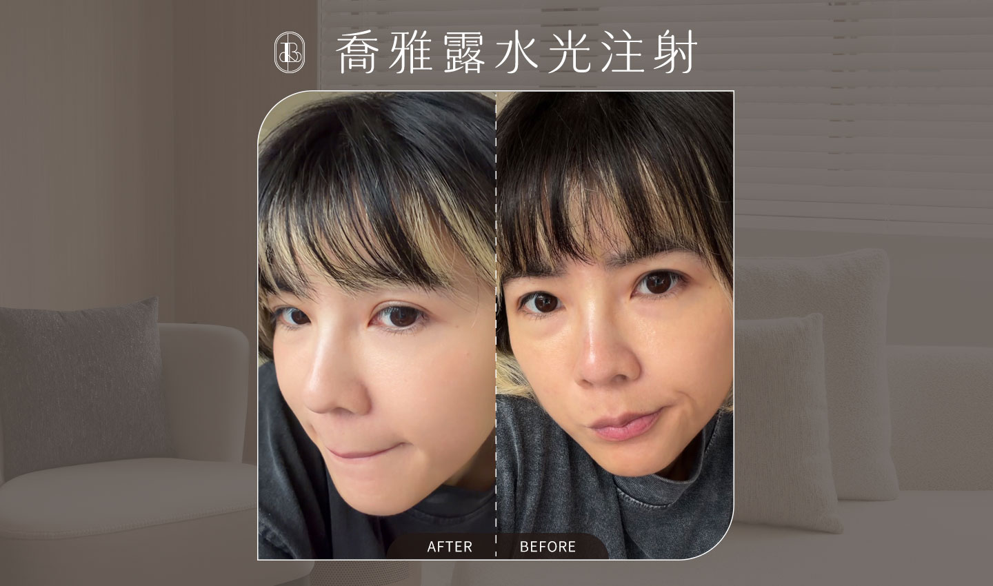 喬雅露水光針-睡睡子-cover
