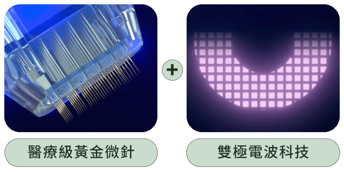 神比微針結合醫療級黃金微針與雙極電波科技
