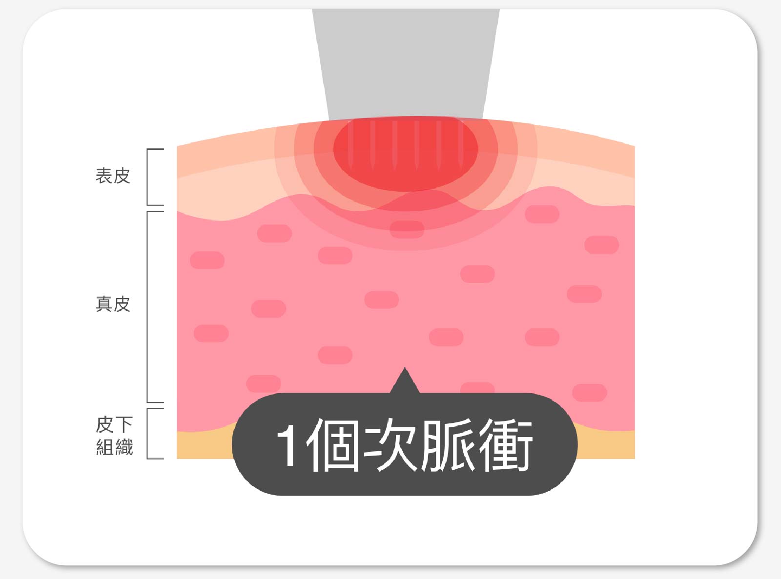 1個次脈衝