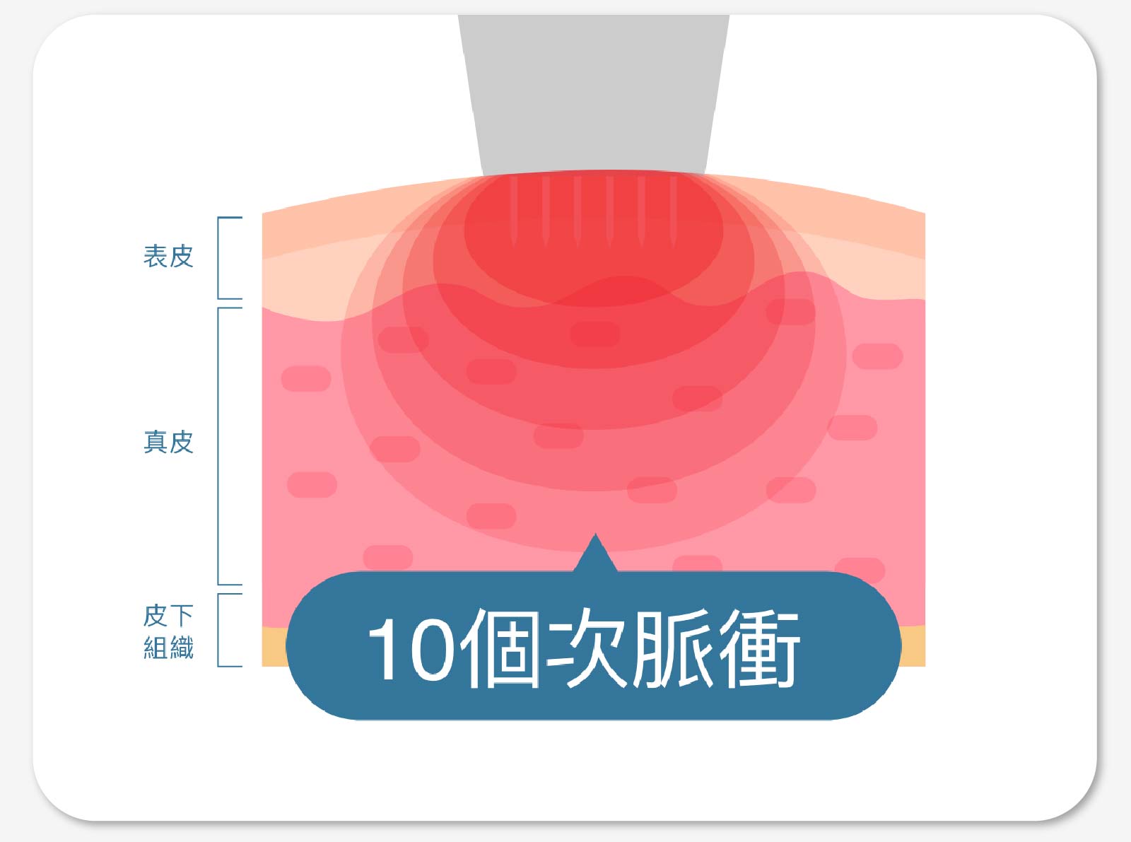 10個次脈衝