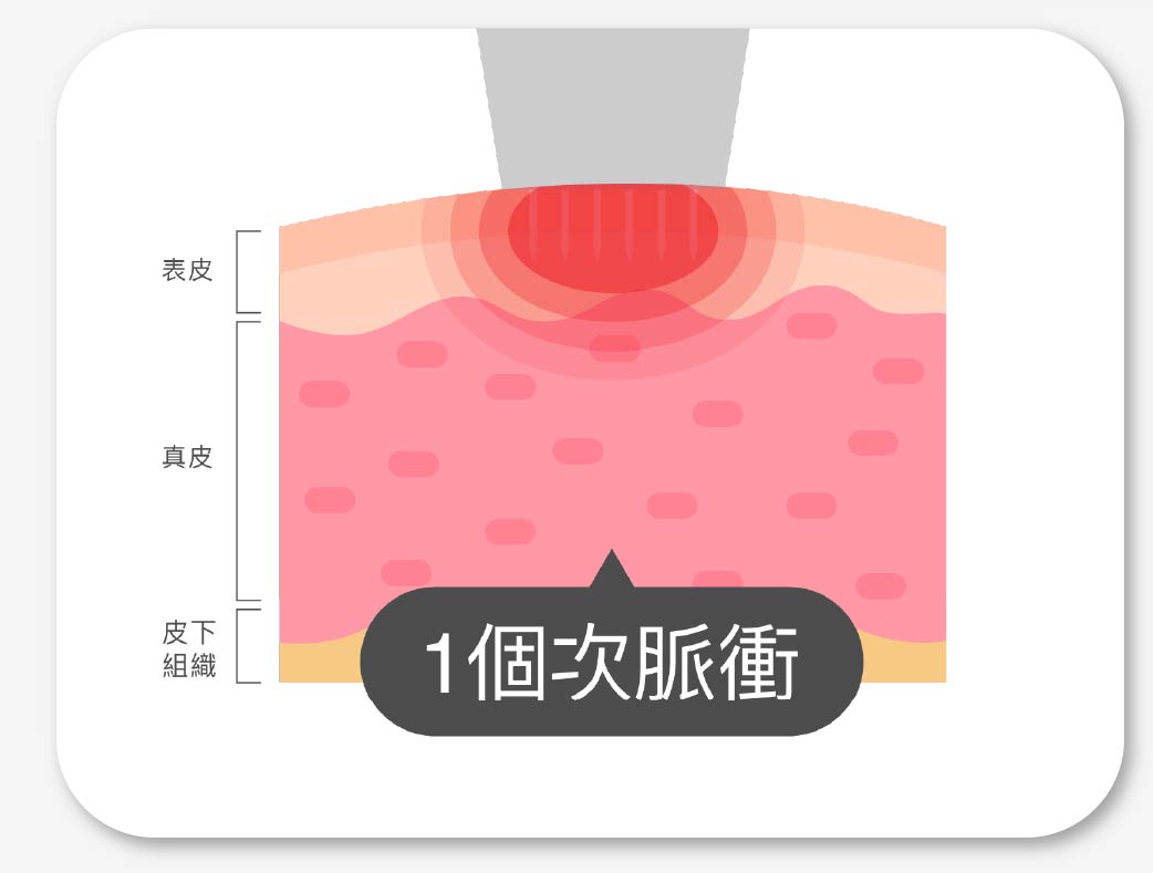 1個次脈衝