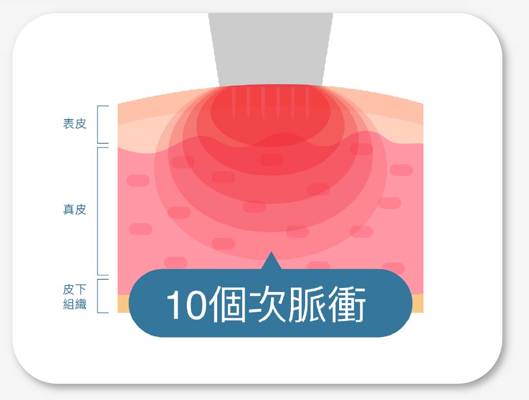 10個次脈衝