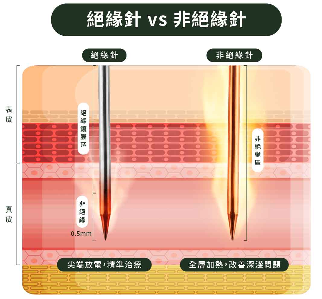 絕緣針 vs 非絕緣針比較