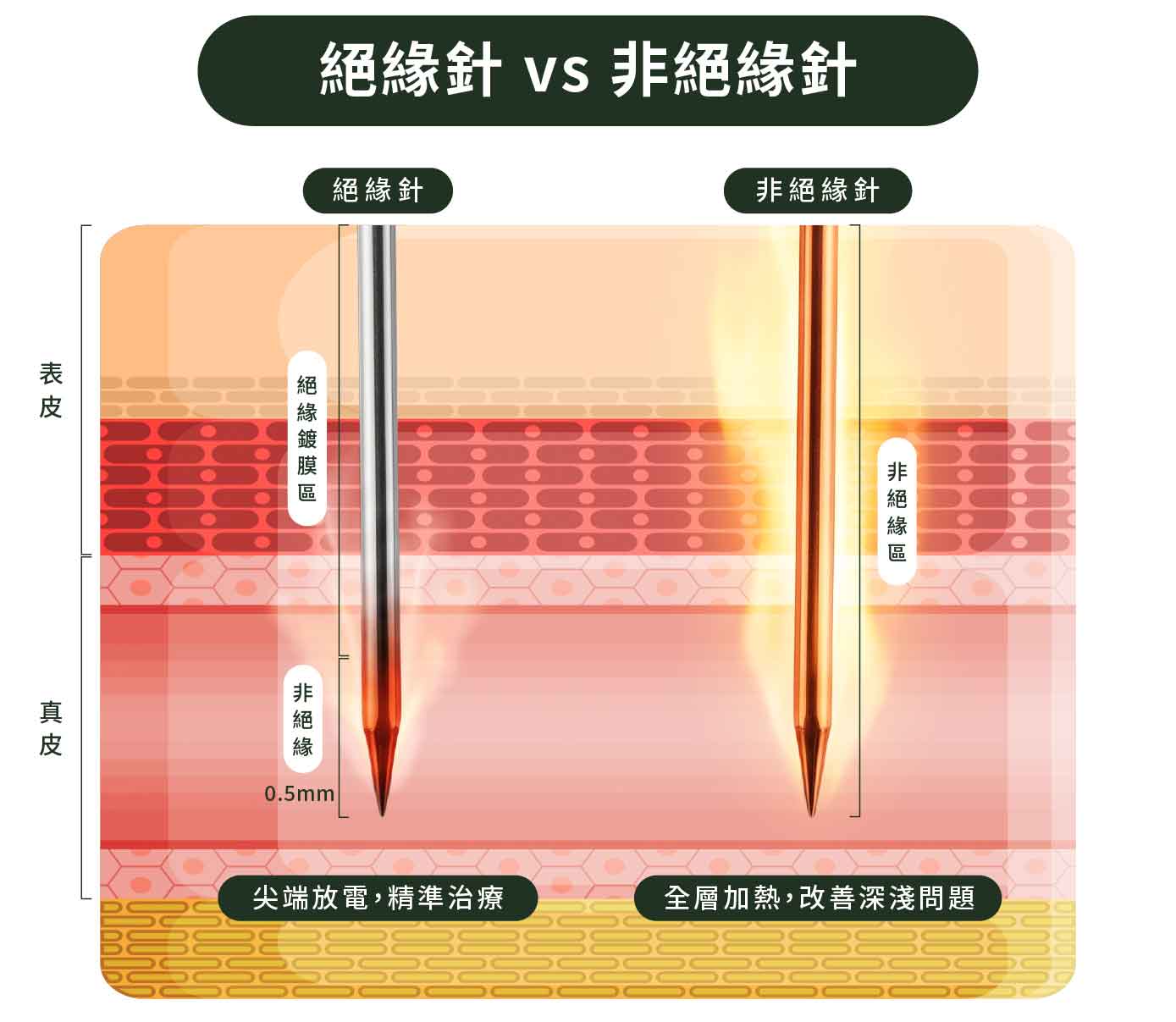 絕緣針 vs 非絕緣針比較