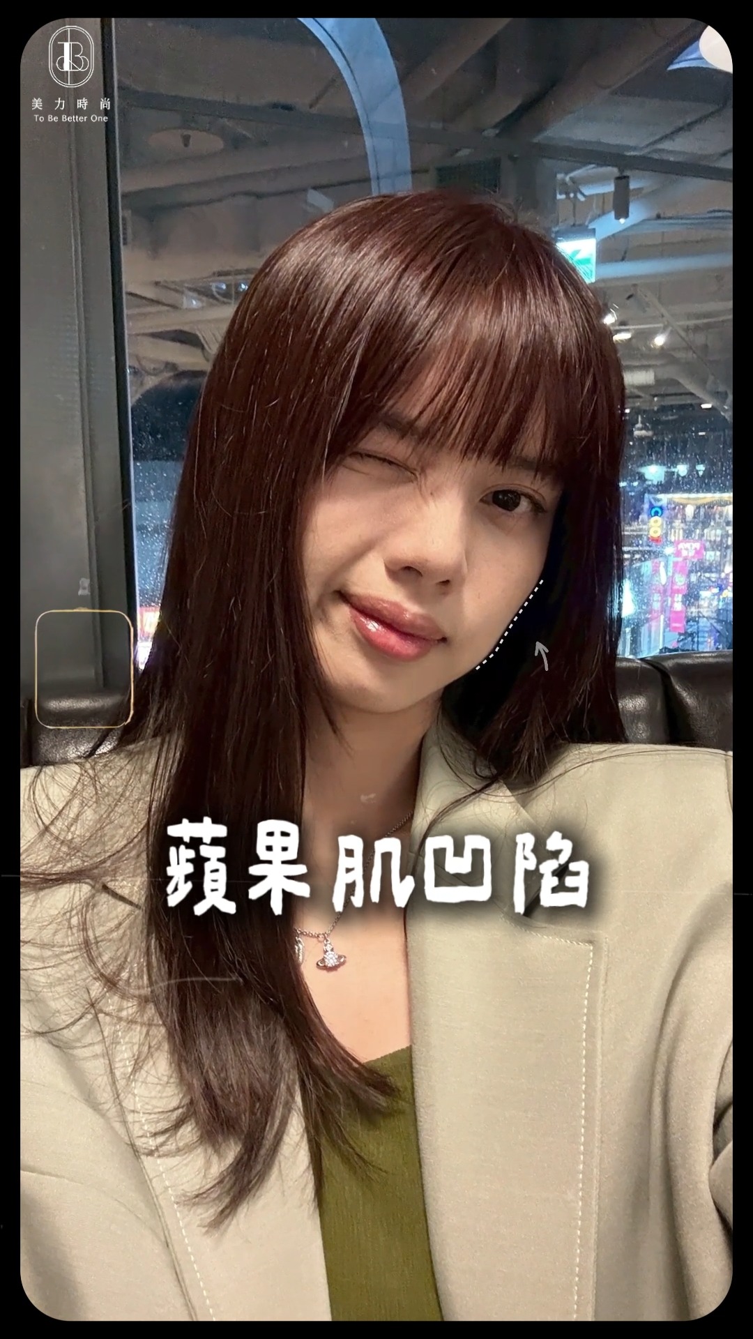 Ruby術前:蘋果肌凹陷