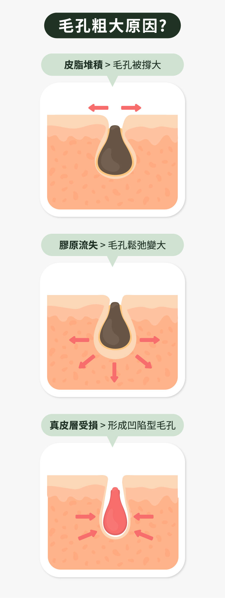 毛孔粗大原因