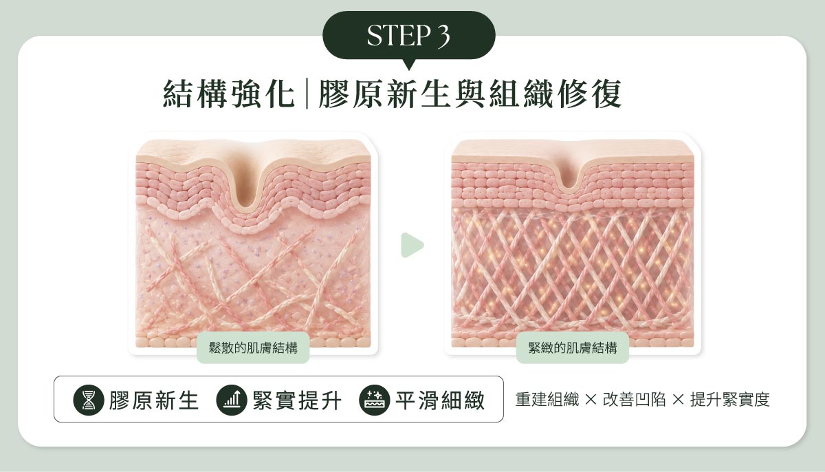 毛孔粗大改善STEP3：結構強化｜膠原新生與組織修復 膠原蛋白纖維由斷裂變緊密
