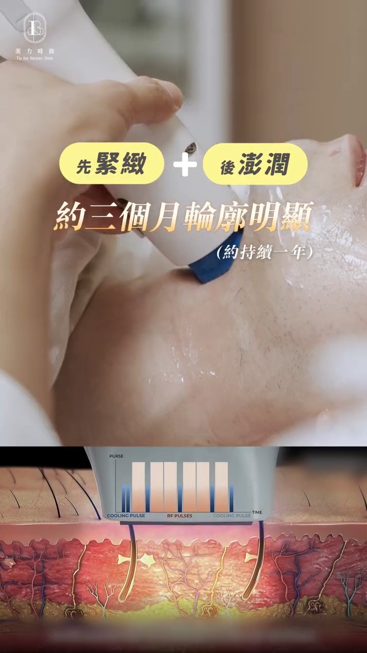 美力時尚診所醫師施打十蓓電波