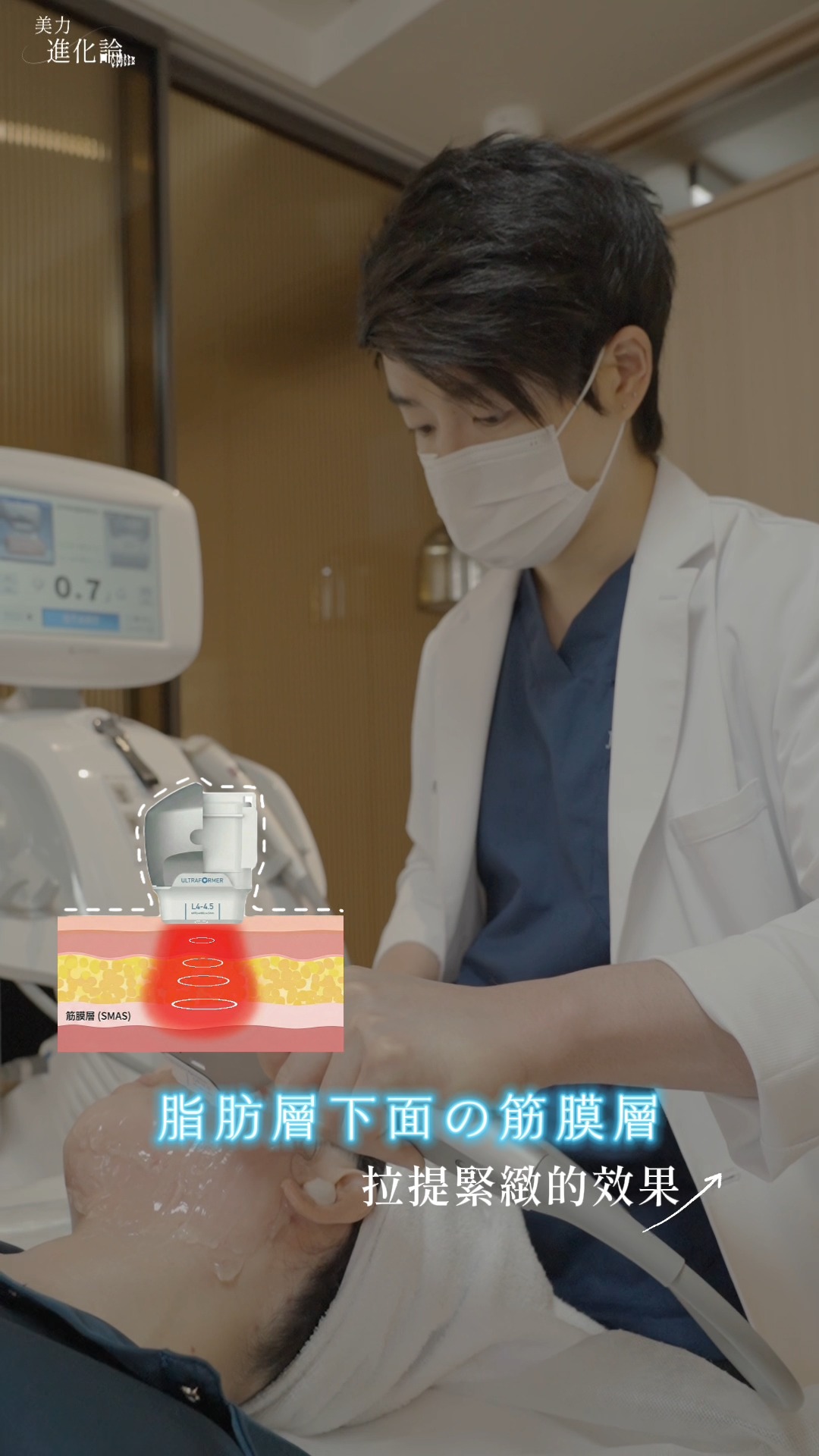施打海芙音波畫面_針對筋膜層拉提