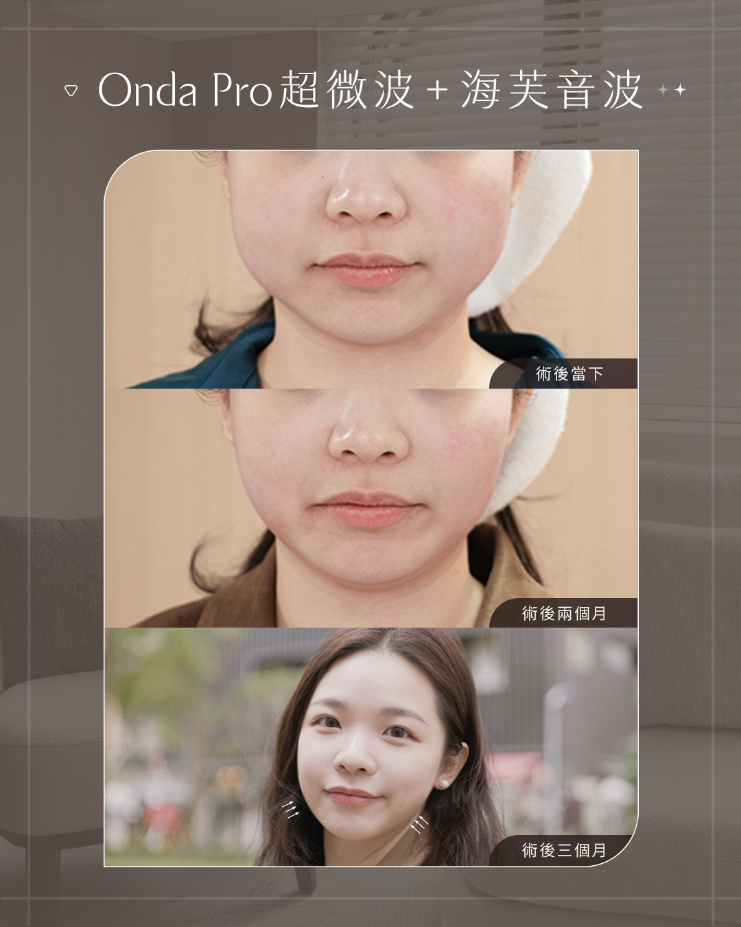 美力時尚診所案例：海芙三+ONDA_BA