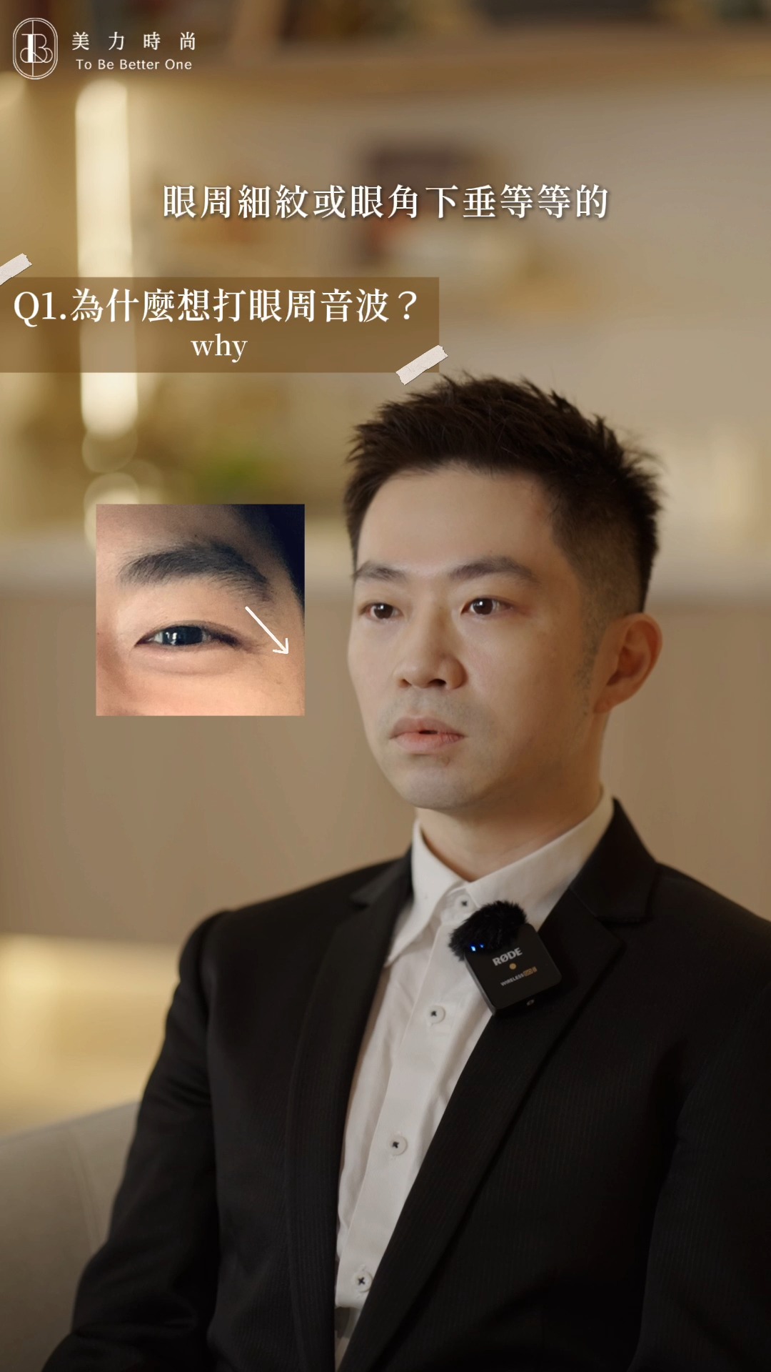 為什麼想打眼周音波?