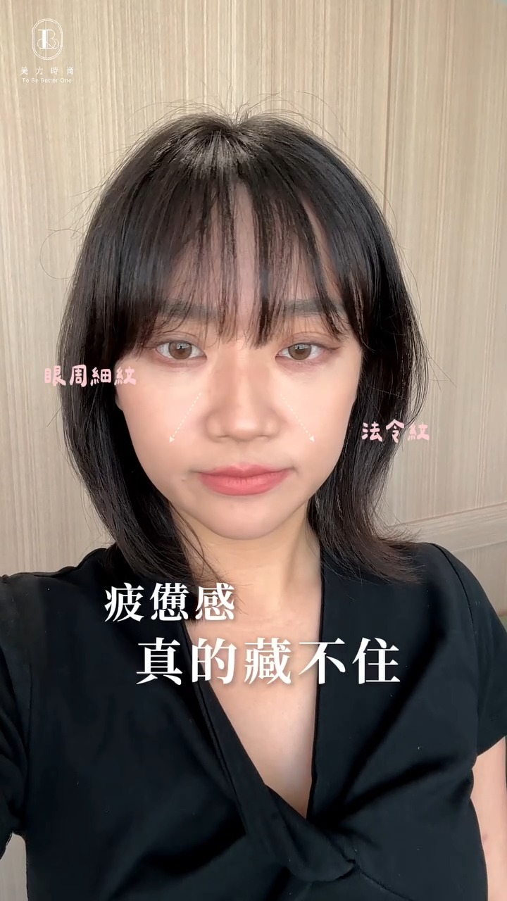 紋雯臉部困擾