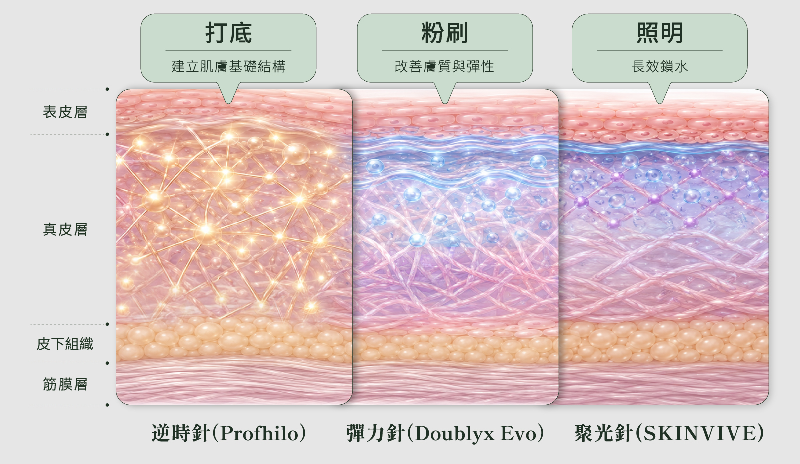 聚光針、逆時針、彈力針施打層次比較