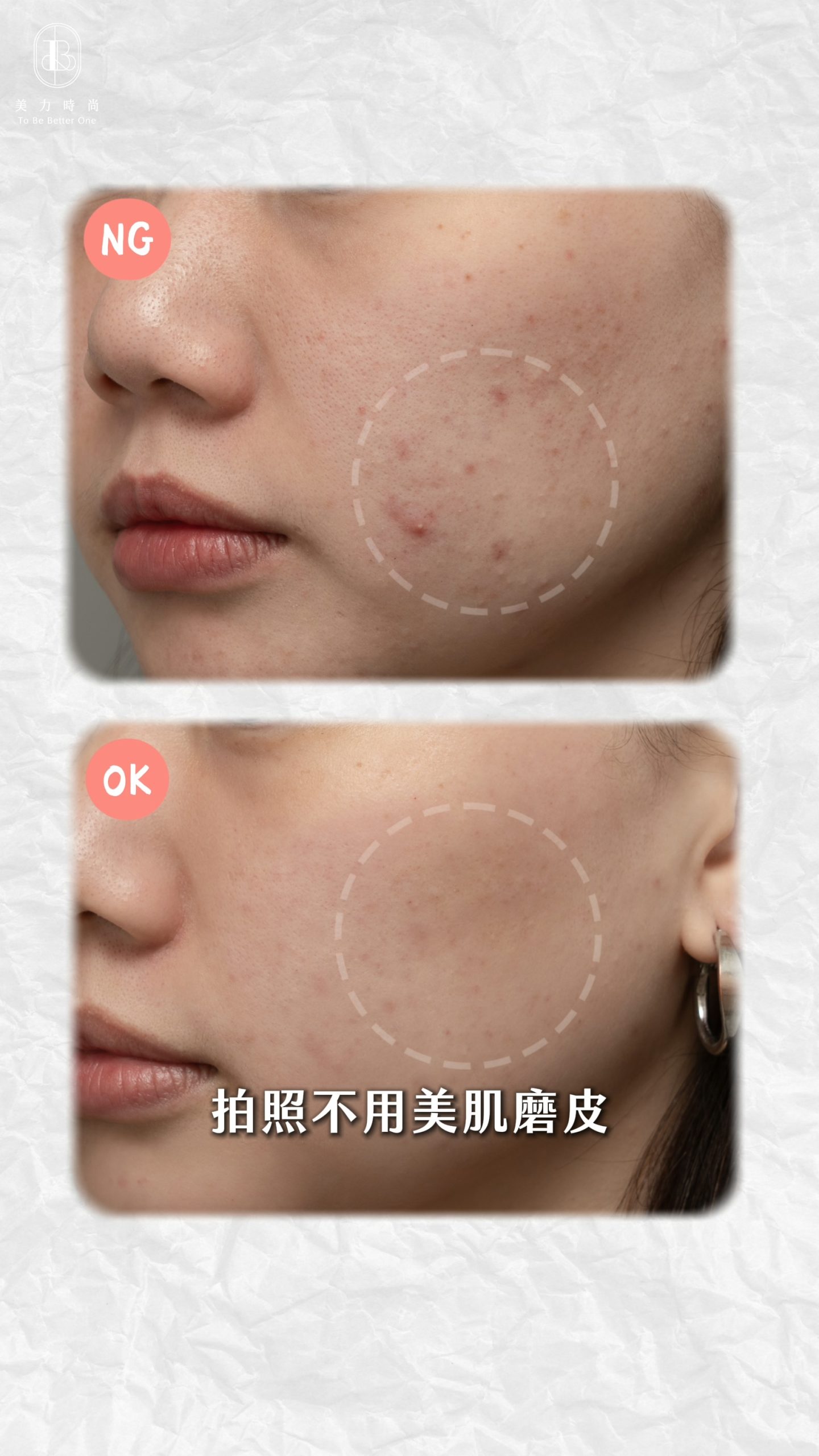 美力時尚診所案例：喬雅露水光BA