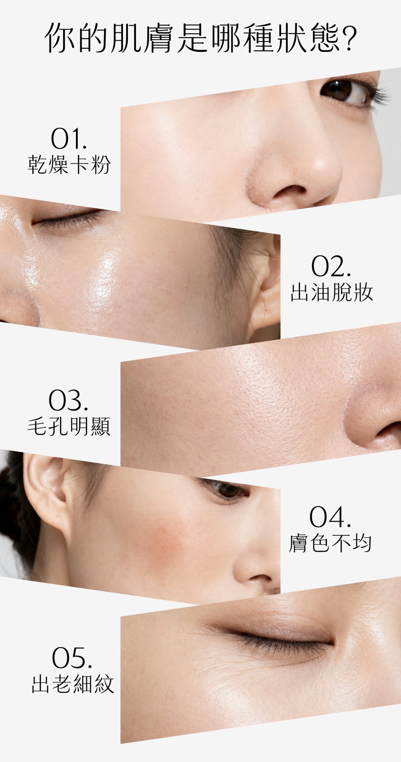 你的肌膚是哪種狀態?