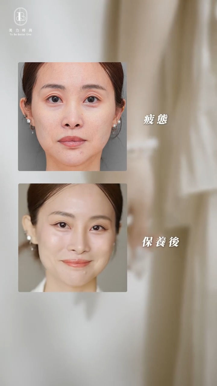 媚必提-彤彤全臉狀態BA