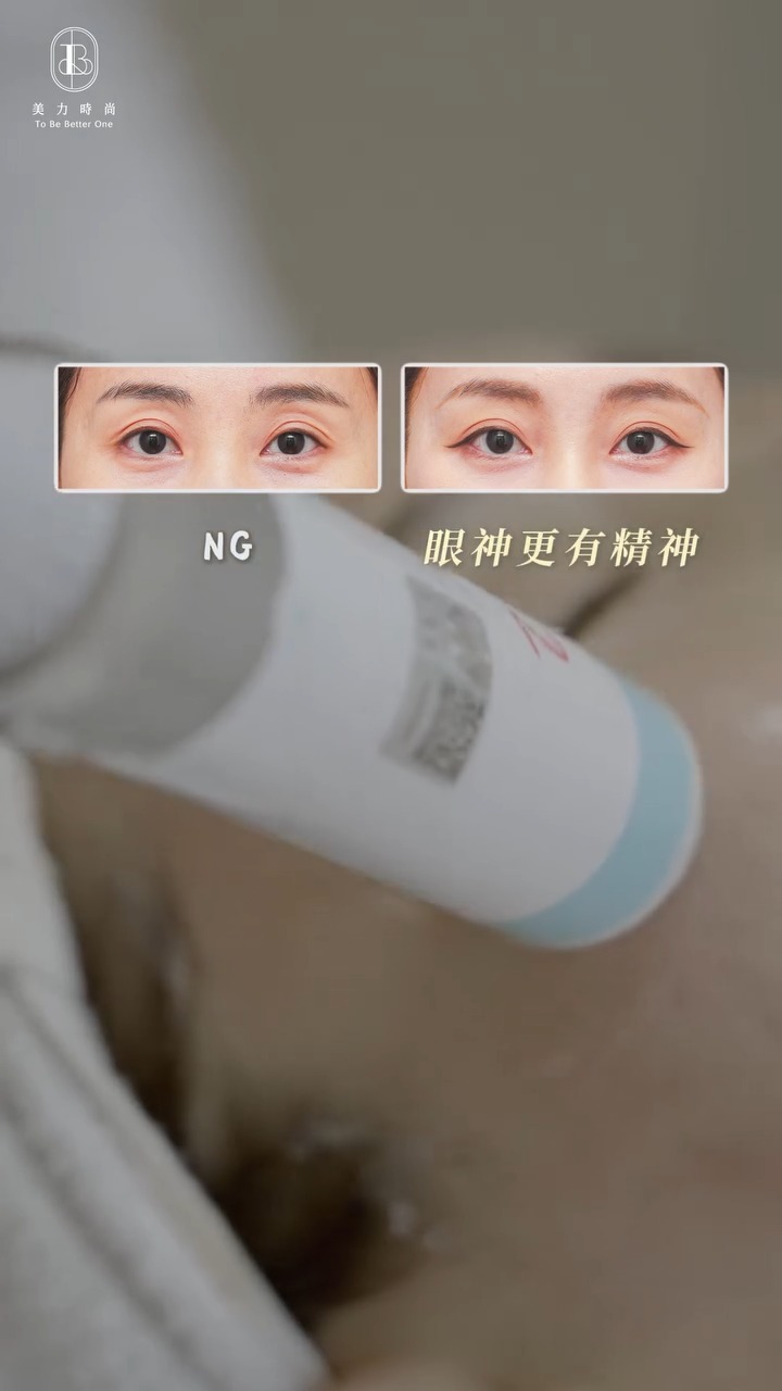 媚必提-彤彤眼周BA