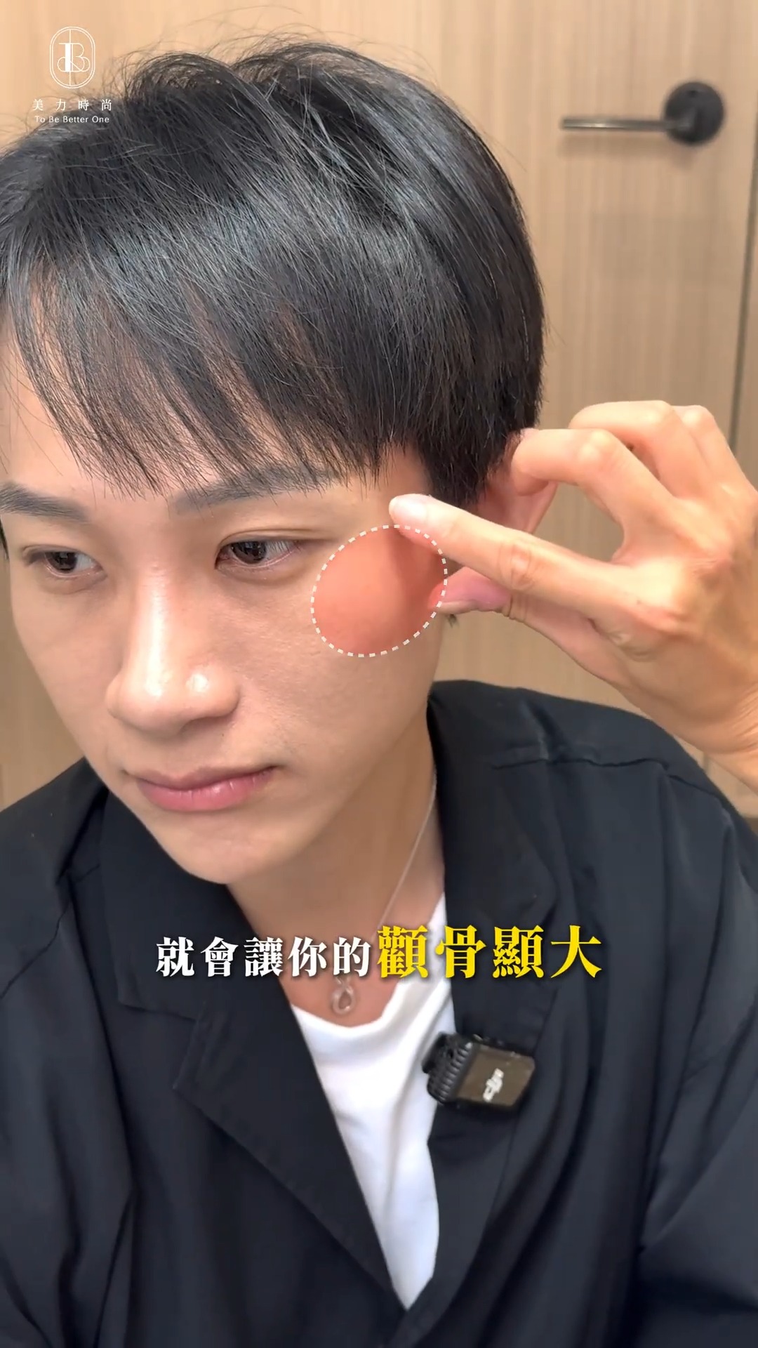 巫婧穎醫師評估_喬雅露填補