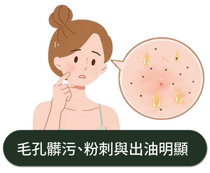 毛孔髒污、粉刺與出油明顯