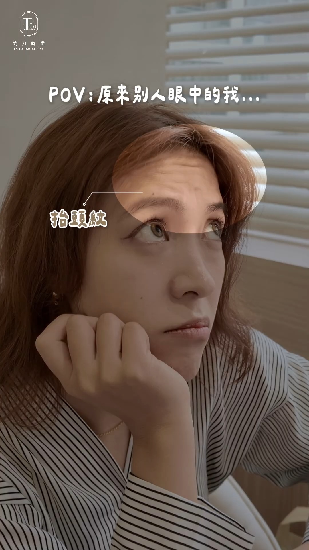 湘湘動態紋路的困擾_抬頭紋